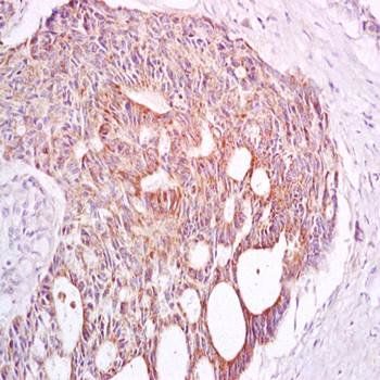 TAAL6 antibody