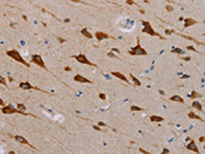 TAB3 Antibody