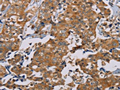 TAB3 Antibody