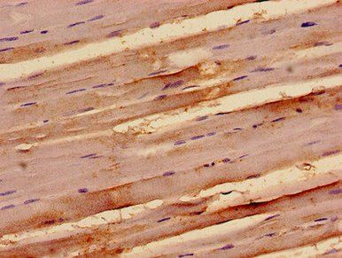 TAB3 Antibody