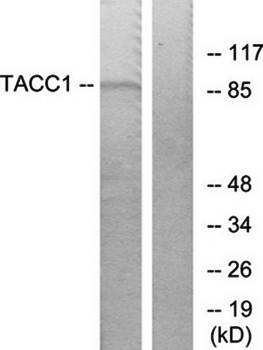 TACC1 antibody
