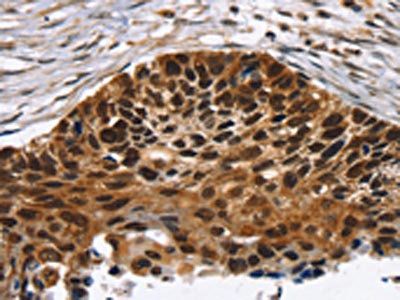 TACC2 Antibody
