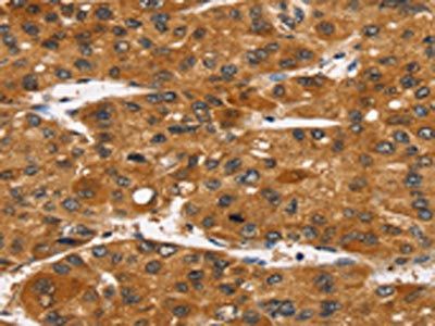 TACC2 Antibody