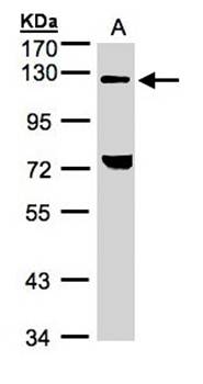 TACC2 antibody