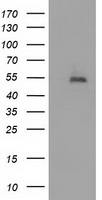 TACC3 antibody