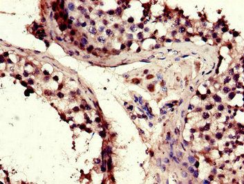 TACC3 antibody