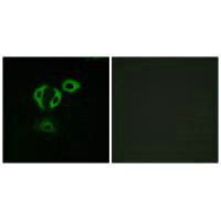 TACC3 Antibody