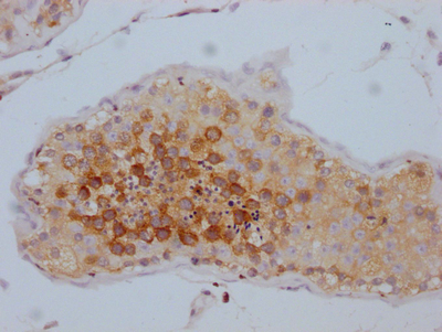TACC3 Recombinant Monoclonal Antibody