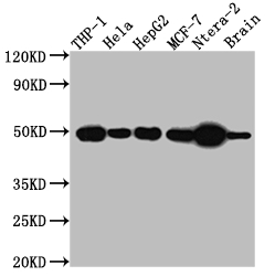 TACR1 Recombinant Monoclonal Antibody
