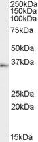 Goat anti-TACR1 Antibody