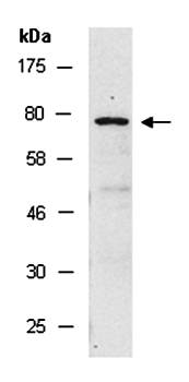 TACR1 antibody