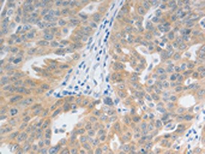 TACR2 Antibody