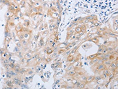 TACR2 antibody