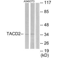 TACSTD2 antibody