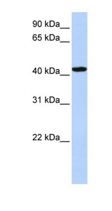 TADA1 antibody