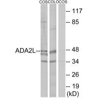 TADA2A antibody