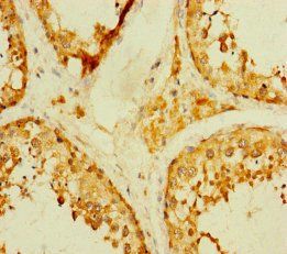 TADA2B Antibody