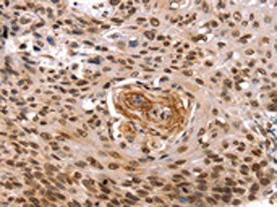 TAF10 Antibody