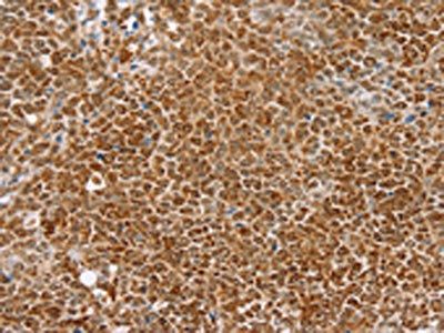 TAF12 antibody