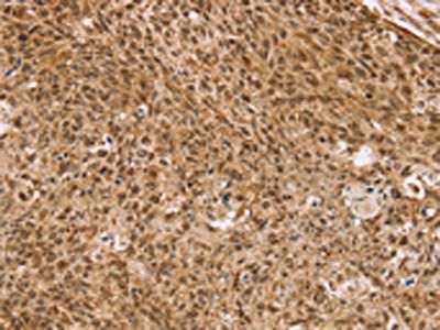 TAF12 antibody