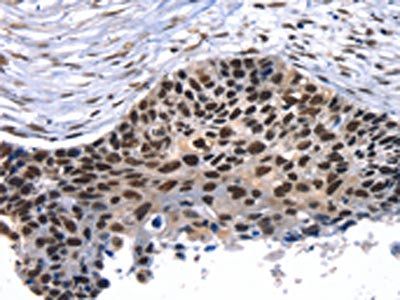 TAF15 Antibody