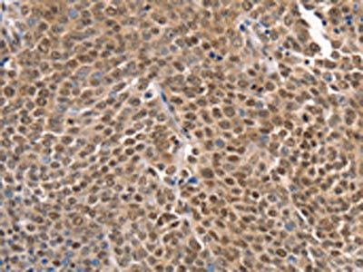 TAF15 antibody