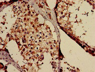 TAF6L Antibody