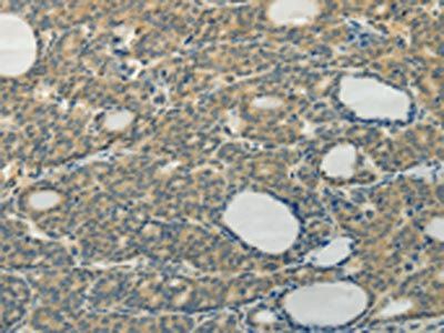 TAGLN2 Antibody