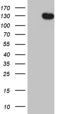 TAK1 (MAP3K7) antibody