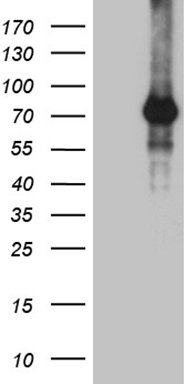 TAK1 (MAP3K7) antibody