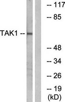 TAK1 antibody