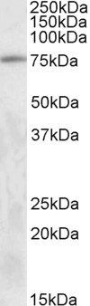 Goat anti-TAK1 / MAP3K7 Antibody
