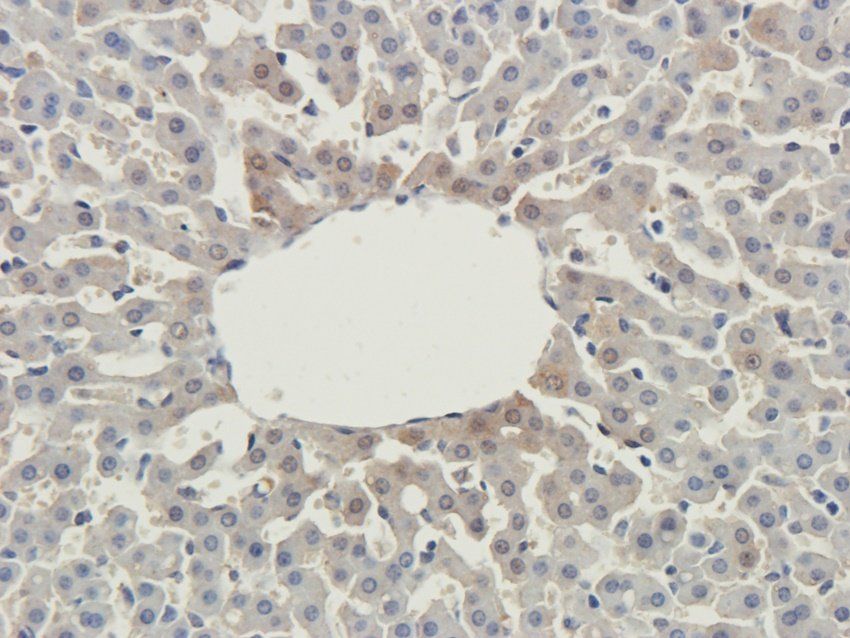 TAL1 antibody