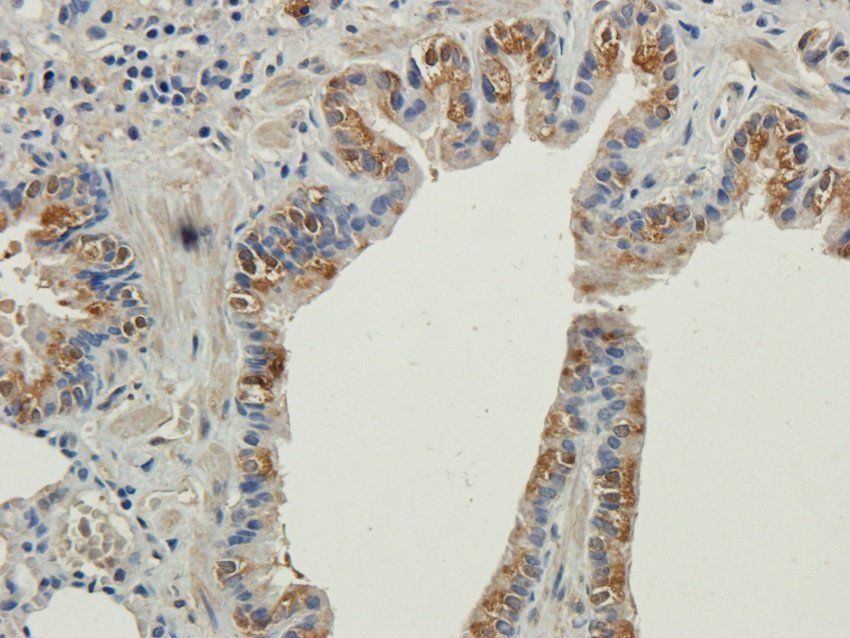 TAL1 antibody