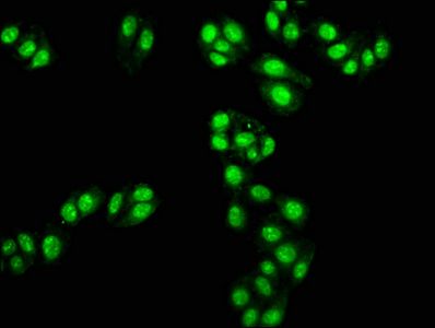 TAL1 antibody