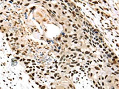 TALDO1 Antibody