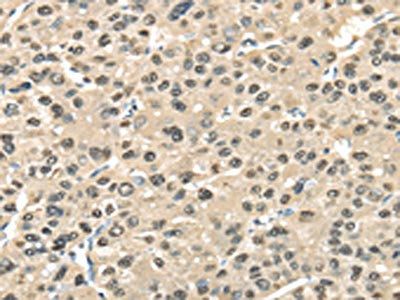 TALDO1 Antibody