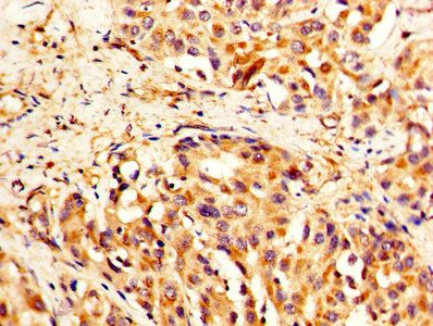 TLN1 Antibody