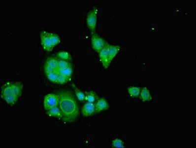 TAMM41 Antibody