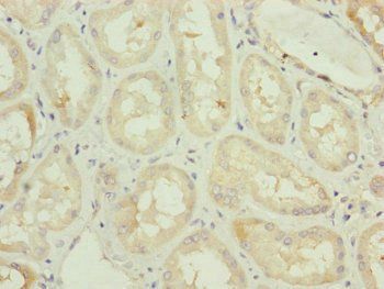 TAMM41 Antibody