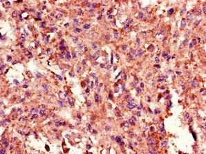 TANK Antibody