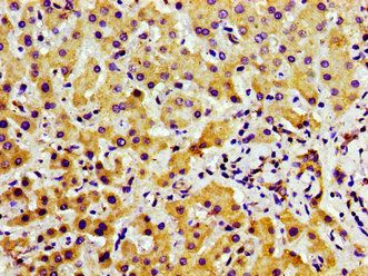 TAOK2 Antibody