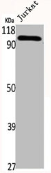 TAOK3 Antibody