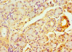 TAP1 Antibody