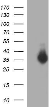 Tapasin Related Protein Antibody