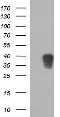 Tapasin Related Protein Antibody