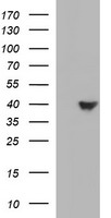 Tapasin Related Protein Antibody