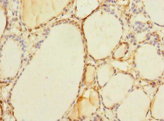 TAPBPL Antibody