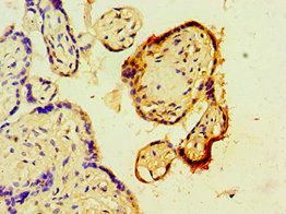 TARBP2 Antibody