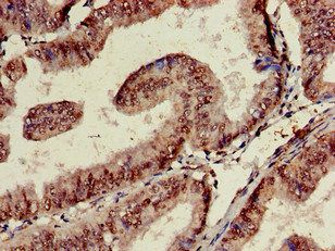 TARDBP Antibody